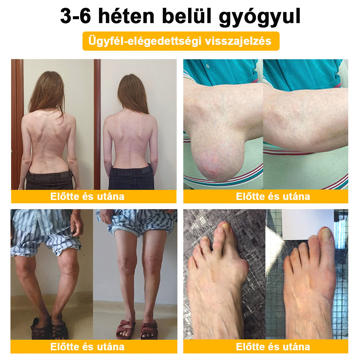 ⭐🎁Már csak 10 doboz maradt!🎁 További 40% kedvezményt adunk! Őrizd meg az egészséged! Ha most kihagyod, idén már nem lesz lehetőség!