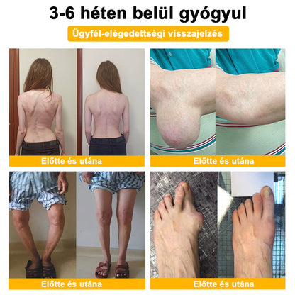⭐🎁Már csak 10 doboz maradt!🎁 További 40% kedvezményt adunk! Őrizd meg az egészséged! Ha most kihagyod, idén már nem lesz lehetőség!