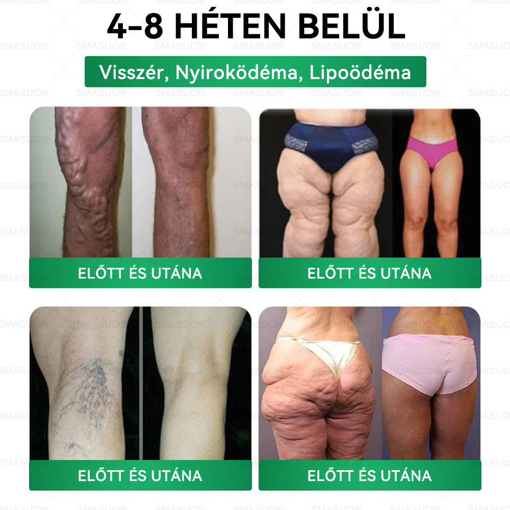 ⭐𝐏𝐙𝐆𝐎𝐍𝐄® Szuperélelmiszer Nano mikrotűs tapasz | Már csak 10 doboz maradt!🎁 További 40% kedvezményt adunk! Őrizd meg az egészséged! Ha most kihagyod, idén már nem lesz lehetőség!