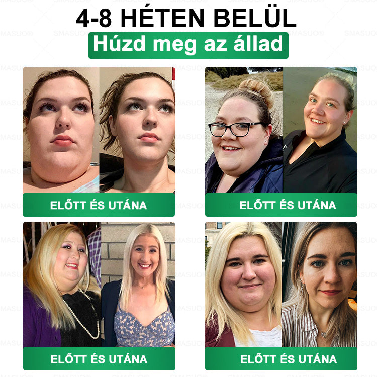 ⭐𝐏𝐙𝐆𝐎𝐍𝐄® Szuperélelmiszer Nano mikrotűs tapasz | Már csak 10 doboz maradt!🎁 További 40% kedvezményt adunk! Őrizd meg az egészséged! Ha most kihagyod, idén már nem lesz lehetőség!